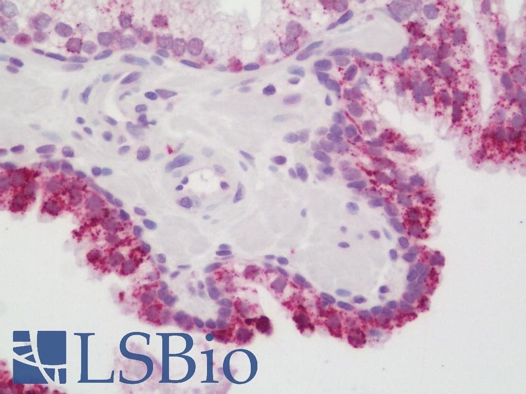 IHC-plus™ Polyclonal Rabbit anti-Human SMAD6 Antibody (aa323-372, IHC, WB)