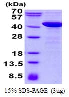 Human P40PHOX / NCF4 Protein (Recombinant His)