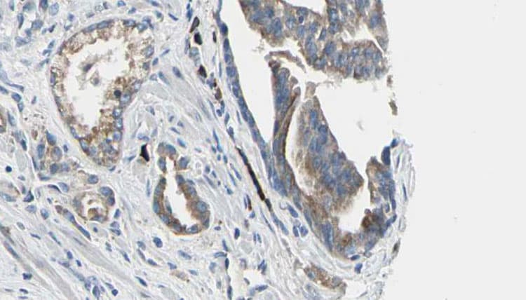 Polyclonal Rabbit anti-Human AICAR / ATIC Antibody (IHC, WB)