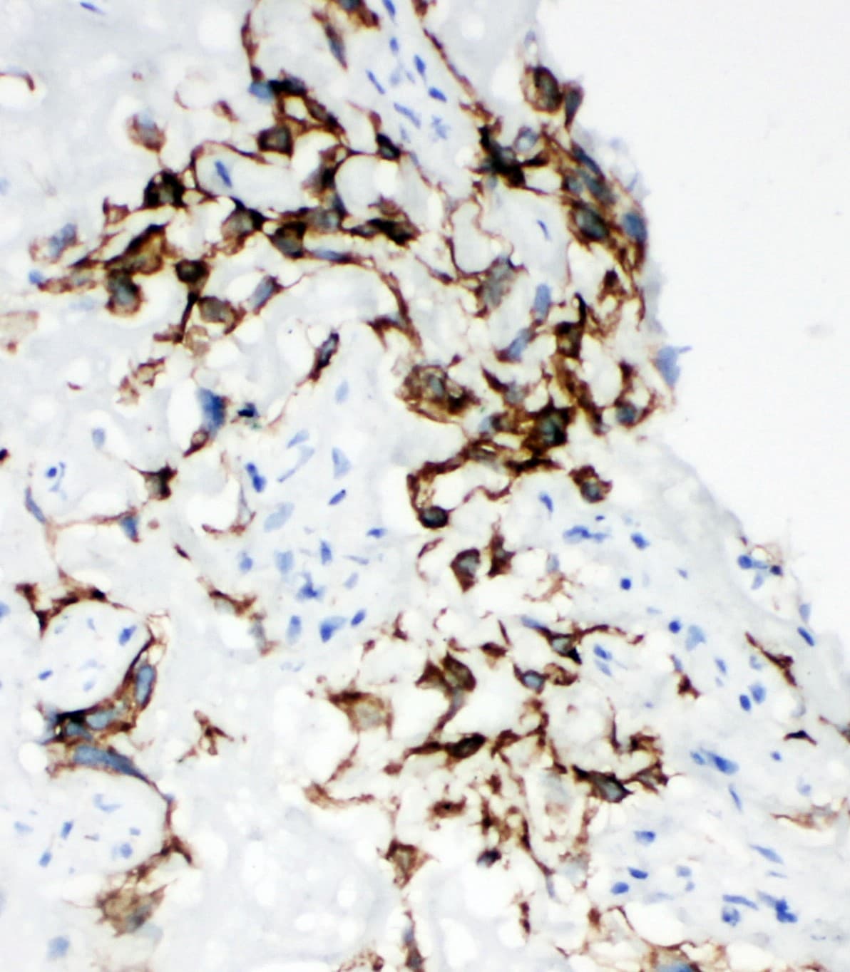 HYAL1 Antibody (aa32-47)