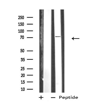 Polyclonal Rabbit anti-Human IRAK2 / IRAK-2 Antibody (IF, WB)