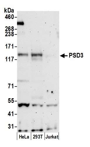 PSD3 Antibody (aa998-1048)