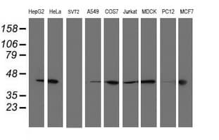 SMS / Spermine Synthase Antibody (clone OTI2H1, Carrier-free)