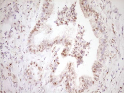 LPIN1 / Lipin 1 Antibody (clone OTI8F10)
