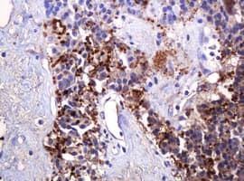 PARVB Antibody (clone OTI3G1)