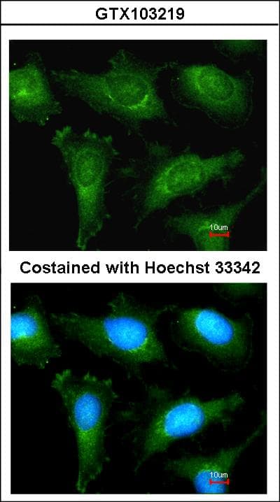 IHC-plus™ ACTN2 Antibody