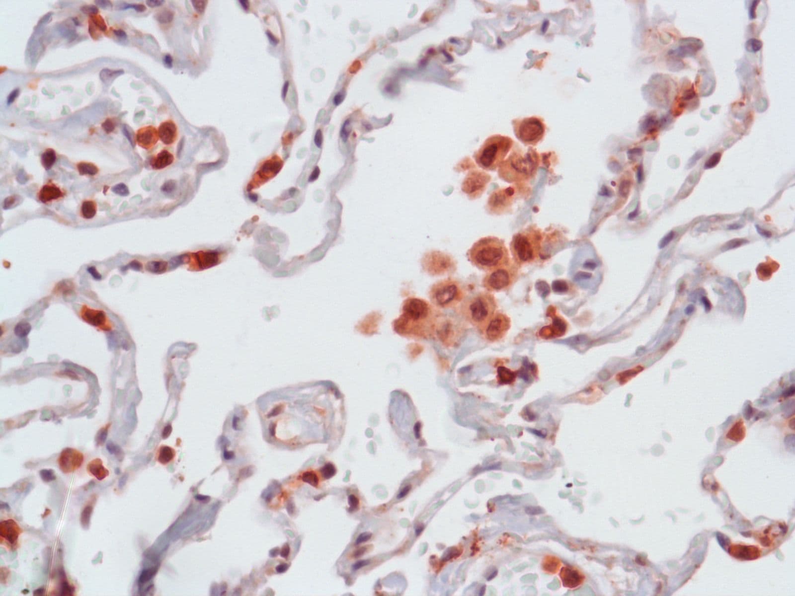 Polyclonal Rabbit anti-Human CCL3 / MIP-1-Alpha Antibody (IHC)