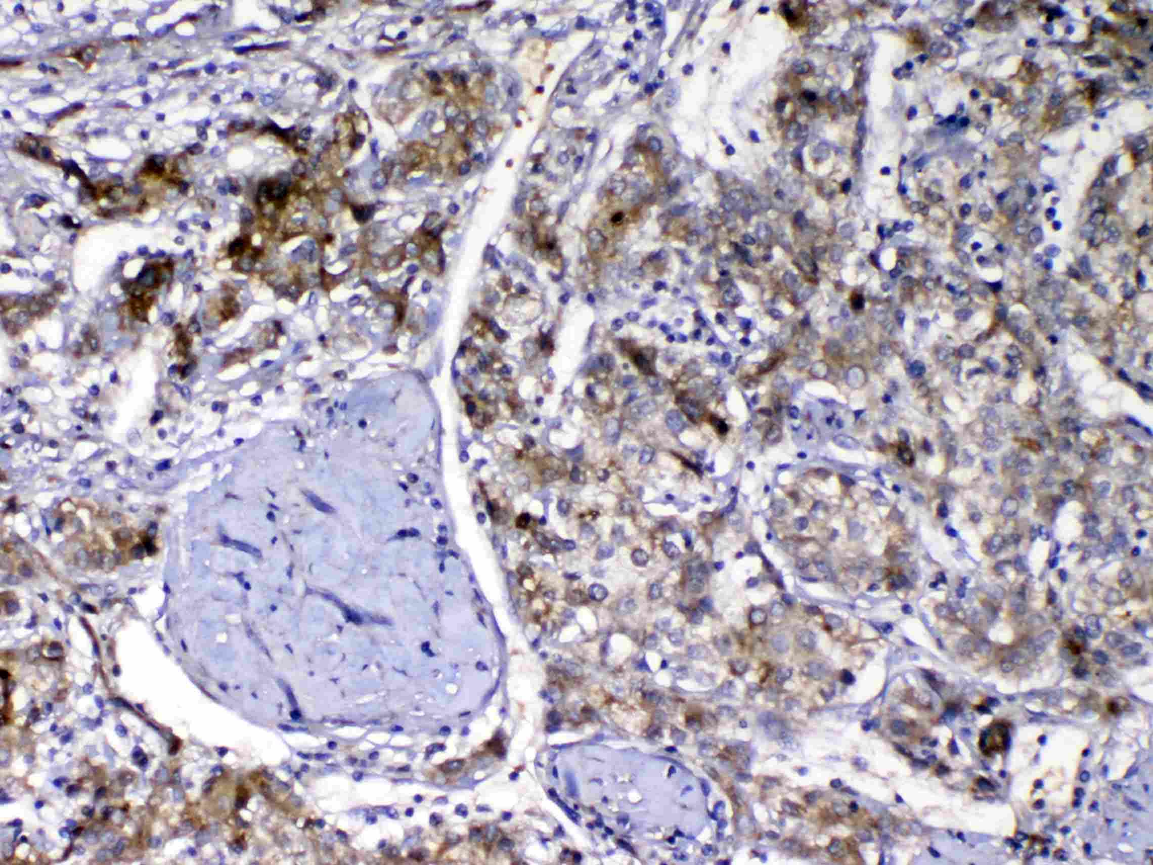 GC / Vitamin D-Binding Protein Antibody
