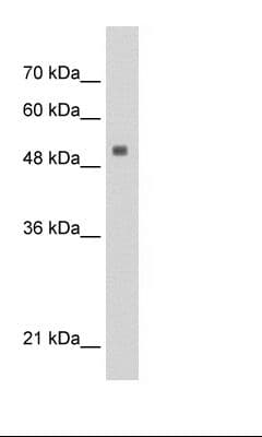 Polyclonal Rabbit anti-Human PAI-RBP1 / SERBP1 Antibody (aa243-292, WB)