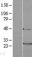 NCS1 / Neuronal Calcium Sensor Protein (Over-Expression Lysate Myc-DDK (Flag))