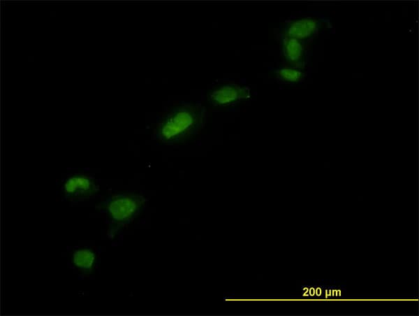 IHC-plus™ HMG1 / HMGB1 Antibody (clone 1D5)