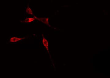 Polyclonal Rabbit anti-Human RPL36 / Ribosomal Protein L36 Antibody (IHC, IF, WB)