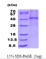 Human KLHDC8B Protein (Recombinant His)