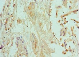 Polyclonal Rabbit anti-Human NIP3 / BNIP3 Antibody (aa1-164, IHC)