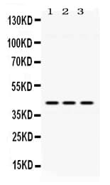 ACAA2 Antibody