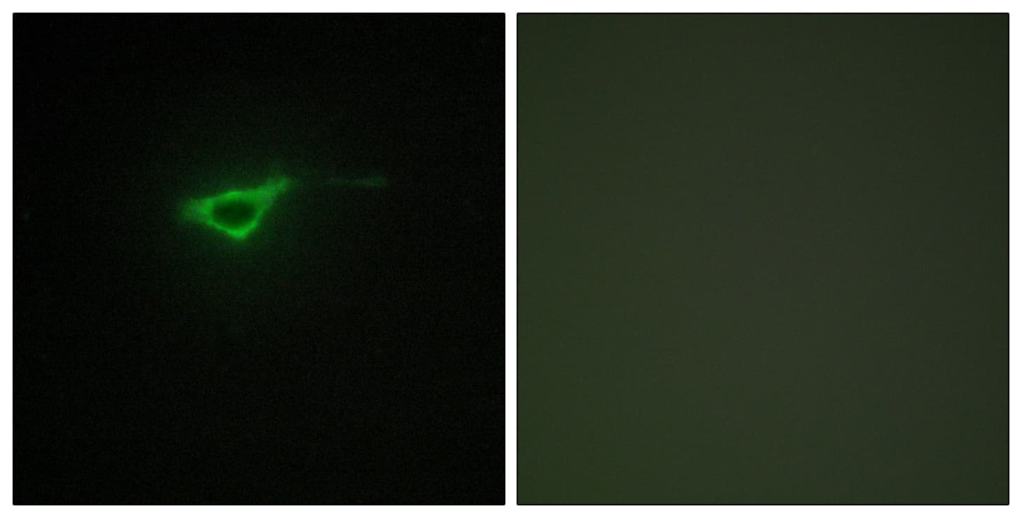Polyclonal Rabbit anti-Human COL20A1 / Collagen XX Antibody (aa1151-1200, IHC, IF, WB)