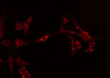 CDH11 / Cadherin 11 Antibody