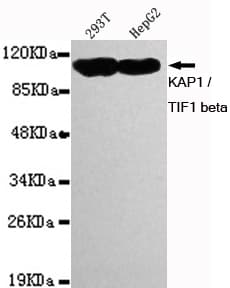 Monoclonal Mouse anti-Human TRIM28 / KAP1 Antibody (IHC, WB)