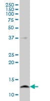 IHC-plus™ CSTB / Cystatin B / Stefin B Antibody (clone M2F1)