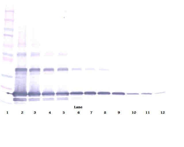 IHC-plus™ Polyclonal Rabbit anti-Human TNFSF11 / RANKL / TRANCE Antibody (IHC, WB)