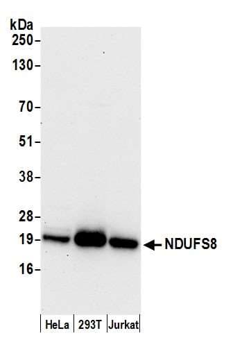 Polyclonal Rabbit anti-Human NDUFS8 Antibody (aa160-210, WB)