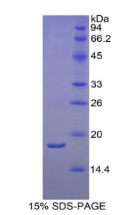 Rat RBP2 / CRBPII Protein (Recombinant His)