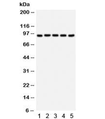 Polyclonal Rabbit anti-Human VIL1 / Villin Antibody (IHC, WB)