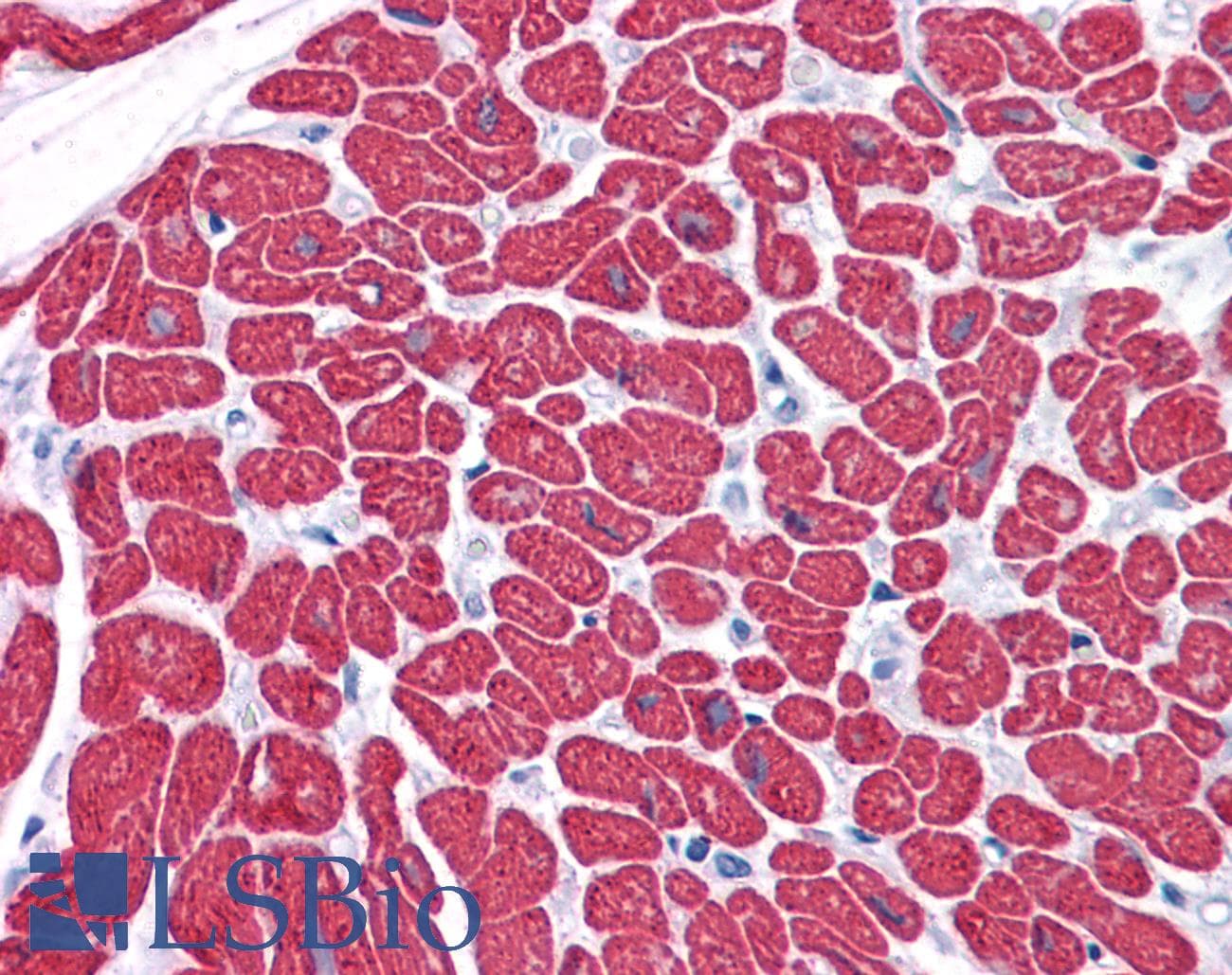 IHC-plus™ MYL3 Antibody (clone 3F8)