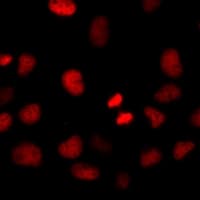 HIRIP3 Antibody