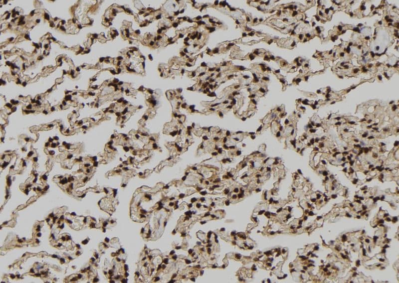 PDE1A Antibody