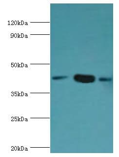 Polyclonal Rabbit anti-Human SMARCB1 / INI1 Antibody (aa86-385, IHC, WB)
