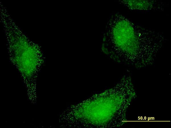 IHC-plus™ HSPA13 Antibody (clone 1H8)