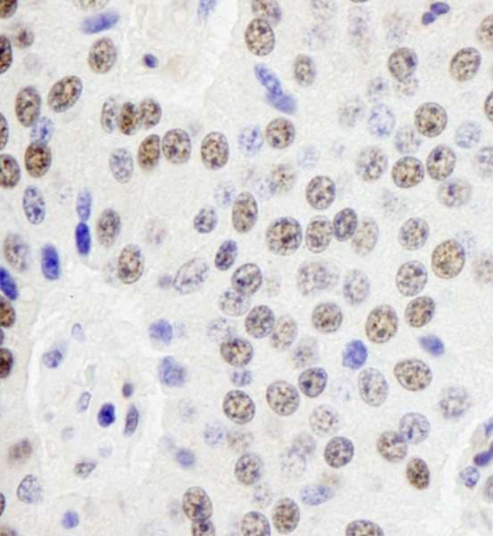 Polyclonal Rabbit anti-Human PD2 / PAF1 Antibody (aa475-525, IHC)
