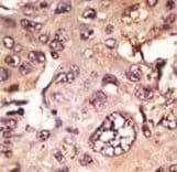 Polyclonal Rabbit anti-Human MAPT / Tau Antibody (aa677-707, IHC, IF, WB)