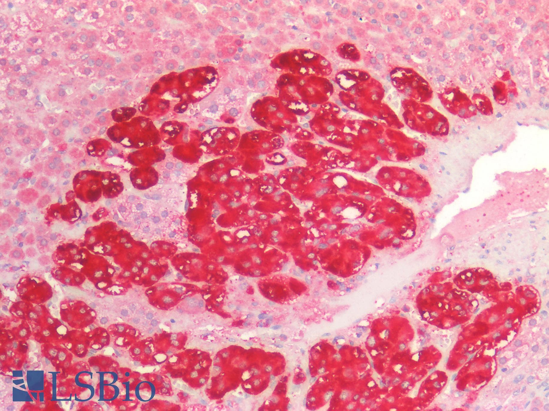 PathPlus™ CDH3 / P-Cadherin Antibody