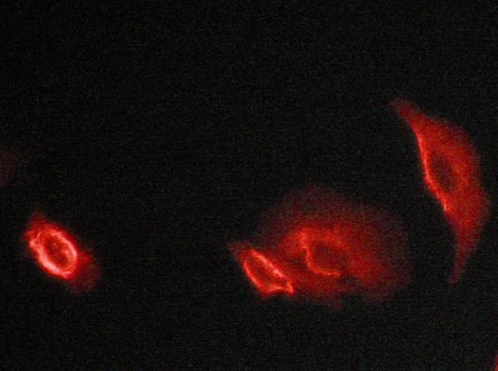 Polyclonal Rabbit anti-Human DAB1 Antibody (IF, WB)