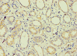 BAG2 Antibody (aa1-211)
