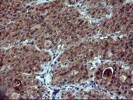 DOCK8 Antibody (clone OTI4F3)