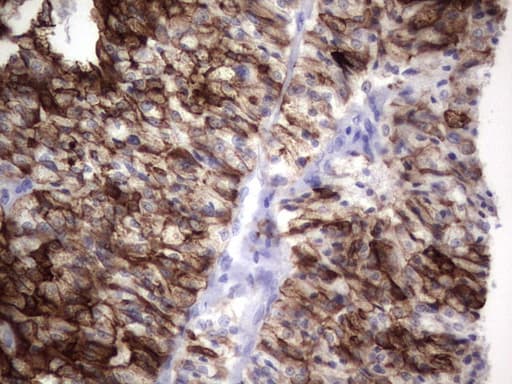 KRT19 / CK19 / Cytokeratin 19 Antibody (aa240-390, clone OTI7H7)
