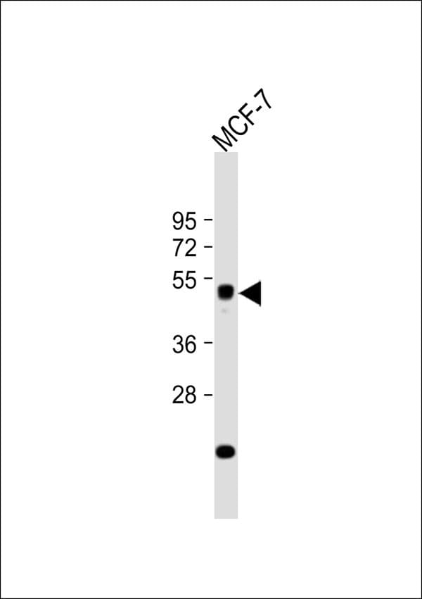 ZFYVE19 Antibody
