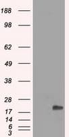 CRYAB / Alpha B Crystallin Antibody (clone OTI3E3, Carrier-free)