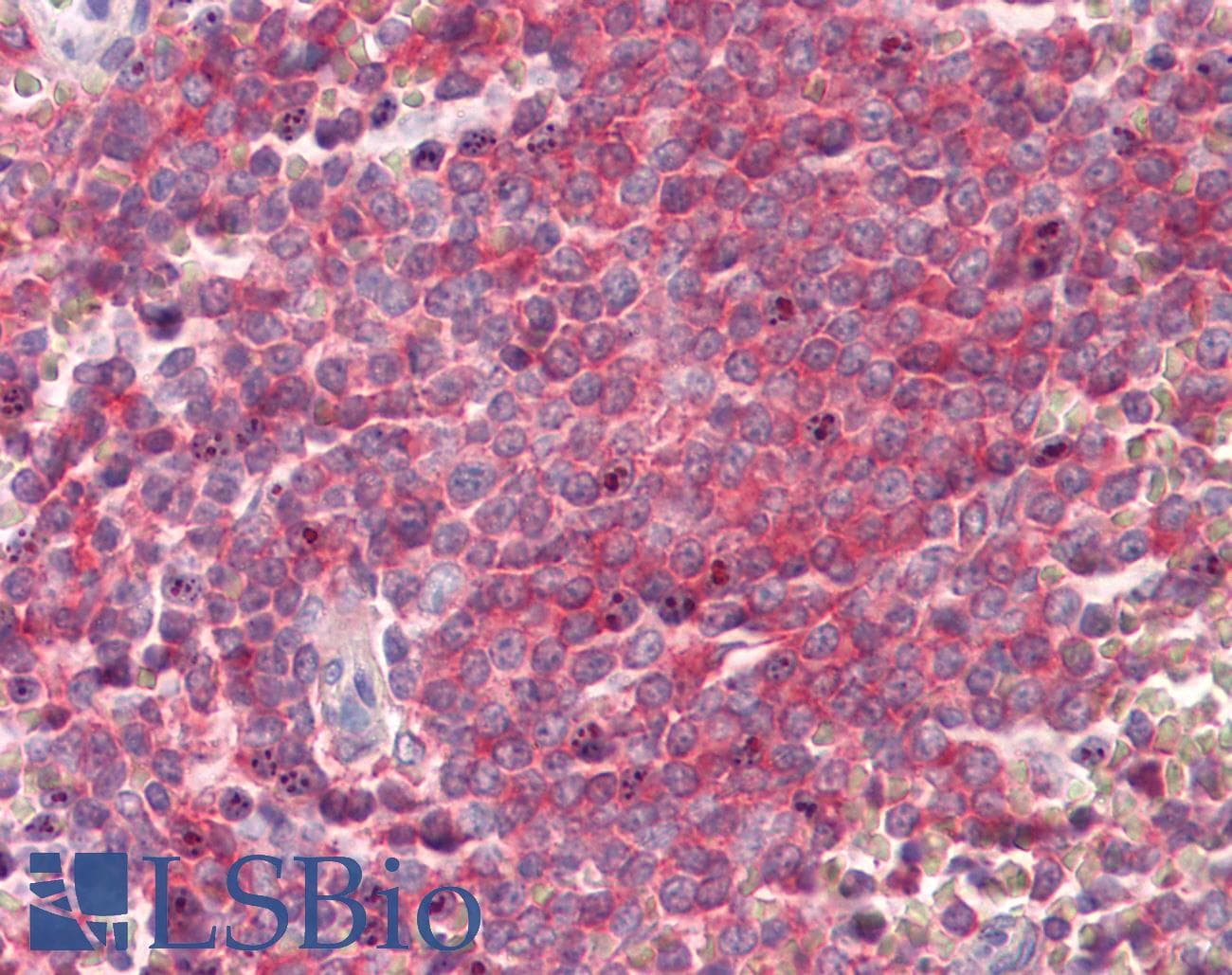 IHC-plus™ SNAP23 / SNAP-23 Antibody (aa130-139)