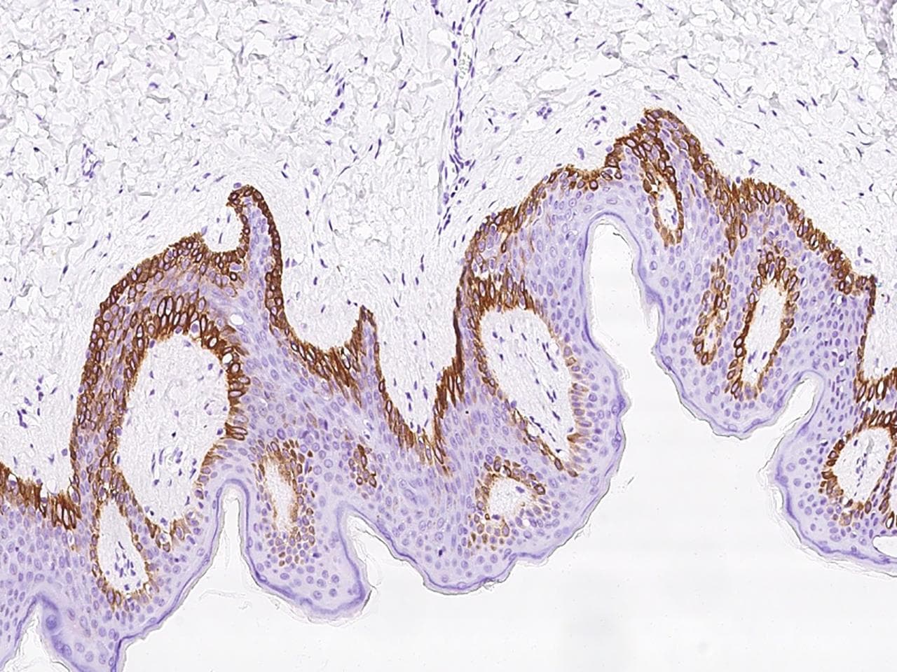 Polyclonal Rabbit anti-Human RAC3 Antibody (IHC)