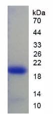 Rabbit IL1RN Protein (Recombinant His)