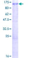 Human ATP6V0A1 Protein (Recombinant GST)