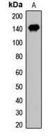 Polyclonal Rabbit anti-Human GTF2I / TFII I Antibody (WB)