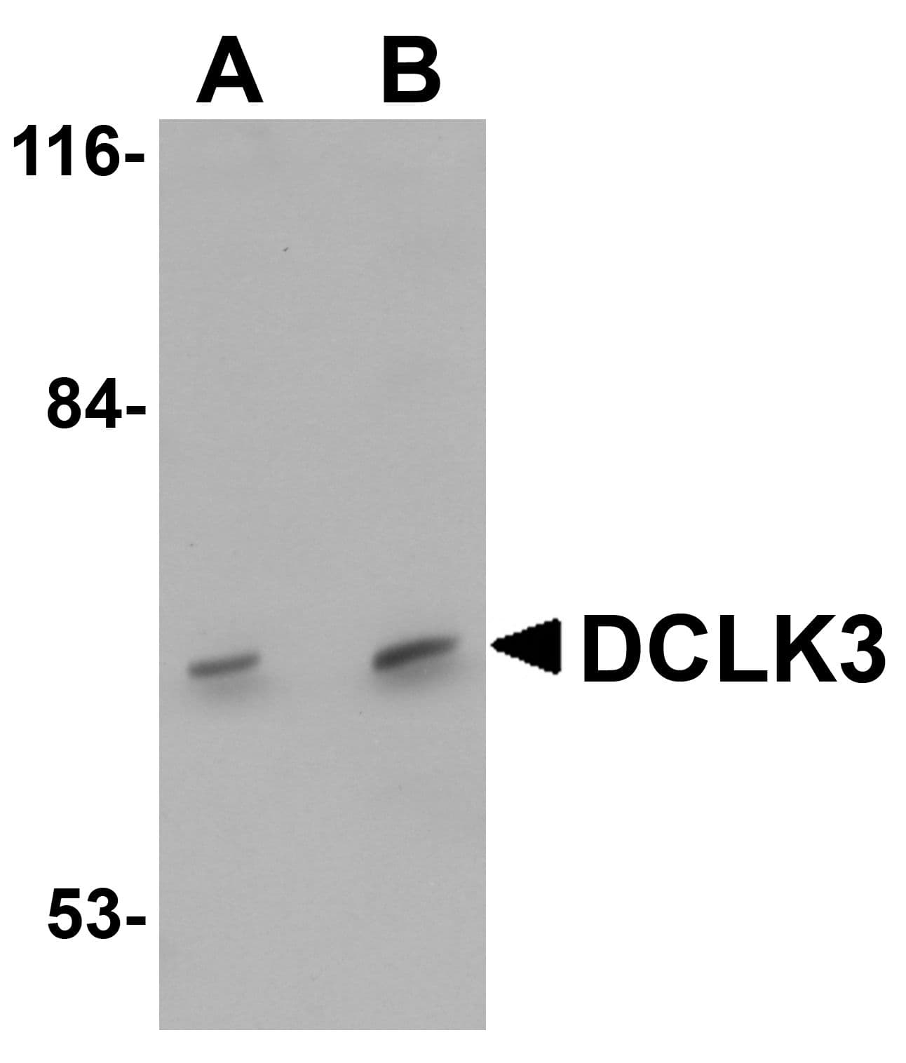 IHC-plus™ Polyclonal Rabbit anti-Human DCLK3 / CLR Antibody (IHC, IF, WB)