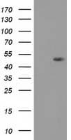 Monoclonal Mouse anti-Human DOK2 Antibody (clone OTI1G9, WB)