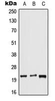 Polyclonal Rabbit anti-Human DUSP14 Antibody (C-Terminus, WB)