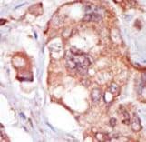 TNK1 Antibody (aa256-286)